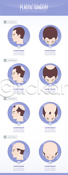 스트레스 남자 성인 여러명 AI(파일형식) 일러스트 다양 대머리 머리 상반신 얼굴 종류 클리닉 탈모 탈모클리닉