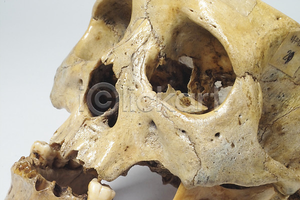 사람 사람없음 JPG 포토 근골격기관 뼈 신체 의료용품 의학 장기(의학) 치료 해골