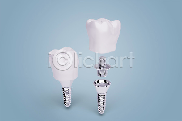 사람없음 3D PSD 디지털합성 편집이미지 3D소스 나사못 임플란트 치과 치아 치아건강 치아모형 합성