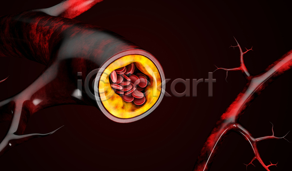 사람없음 3D JPG 포토 해외이미지 단면 동맥경화 세포 적혈구 콜레스테롤 혈관 혈구