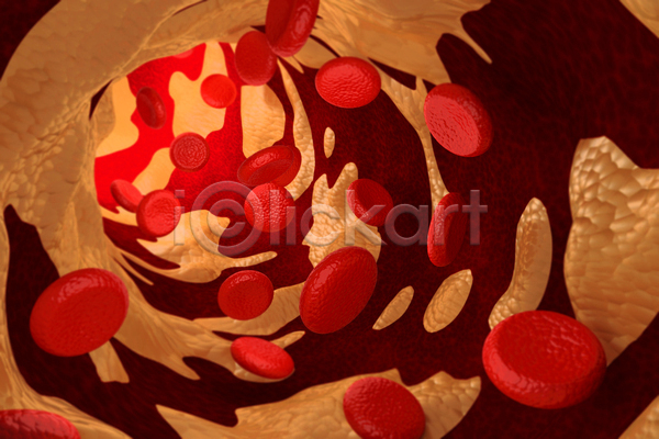 사람없음 3D JPG 포토 해외이미지 동맥경화 세포 적혈구 혈관 혈구