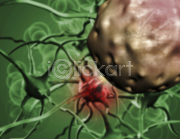 사람없음 3D JPG 디지털합성 포토 해외이미지 세포 암 의학 종양 질병 초록색