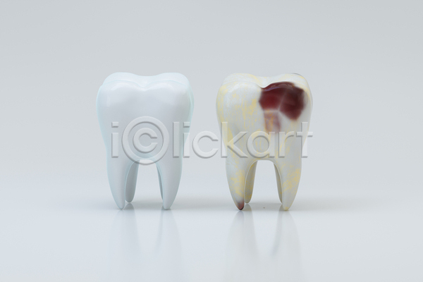 사람없음 3D JPG 해외이미지 손상 의학 충치 치아 치아건강 치아관리 흰색