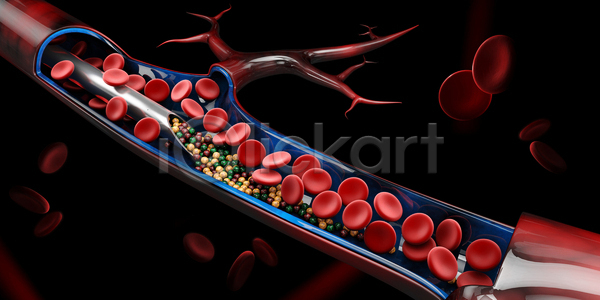 사람없음 3D JPG 포토 해외이미지 비타민(영양소) 세포 적혈구 정맥 주사기 투입 혈관 혈구