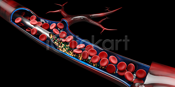 사람없음 3D JPG 포토 해외이미지 비타민(영양소) 세포 적혈구 정맥 주사기 투입 혈구