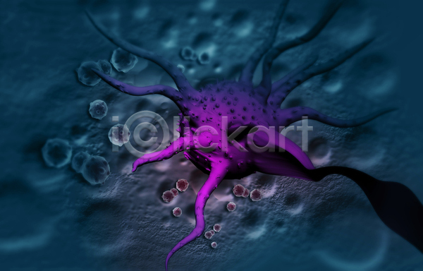사람없음 3D JPG 디지털합성 포토 해외이미지 보라색 세포 암 의학 종양 질병 파란색