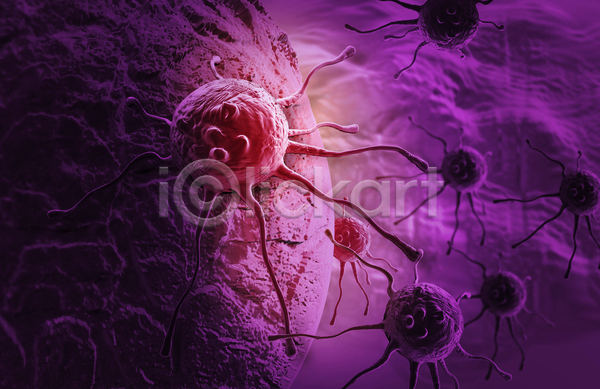 사람없음 3D JPG 디지털합성 포토 해외이미지 보라색 세포 암 의학 종양 질병