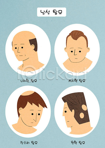 고민 남자 성인 성인남자만 여러명 PSD 일러스트 다양 대머리 머리 부분탈모증 원형탈모 종류 증상 탈모 탈모클리닉