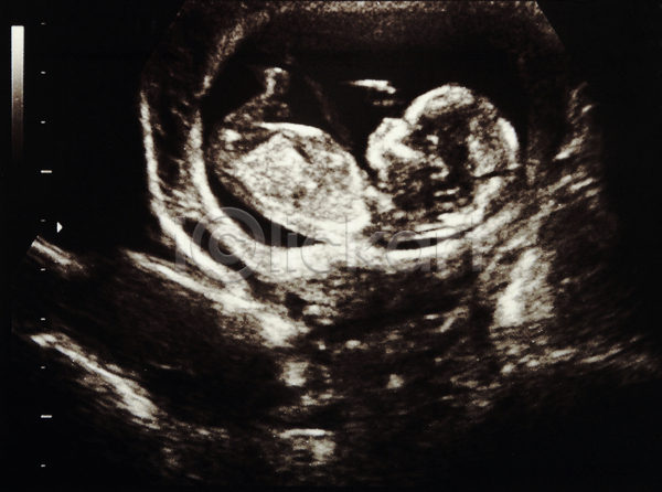 사람 사람없음 아기 어린이 여자 JPG 포토 해외이미지 4 과학 돌봄 소리 약 엄마 월 일주일 임신 자궁 태교 태아