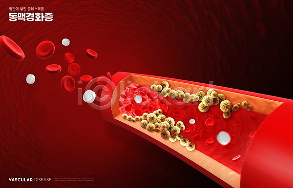 위험 사람없음 PSD 편집이미지 동맥경화 빨간색 의학 적혈구 질병관리 콜레스테롤 혈관 혈관질환 혈액