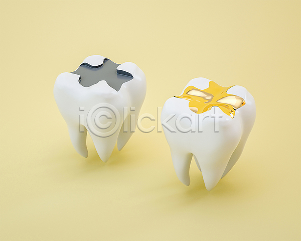 사람없음 3D 3D아이콘 PSD 디지털합성 금니 노란색 충치 치과진료 치료 치아 치아건강 치아모형 편집 편집소스
