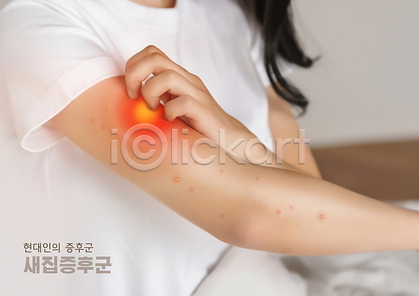 고통 20대 성인 성인여자한명만 여자 한국인 한명 PSD 편집이미지 긁기 상반신 손 염증 증후군 팔 피부 피부염 피부질환 피부트러블