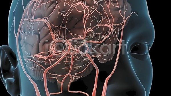 사람없음 3D JPG 포토 해외이미지 뇌 뇌졸중 뇌출혈 생명과학 생물학 신경기관 신경세포 연결 질병 해외202309