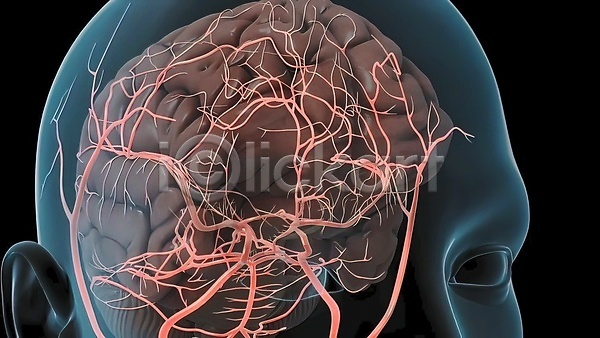 사람없음 3D JPG 포토 해외이미지 뇌 뇌졸중 뇌출혈 생명과학 생물학 신경기관 신경세포 연결 질병 해외202309