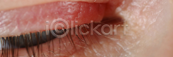고통 남자 사람 사람없음 JPG 포토 해외이미지 감각 감염 광학 내추럴 노력 노화 눈동자 묘사 바이러스 반사 부분 붓꽃 비전 빨간색 생물 생물학 속눈썹 시력 안과 약 약속 얼굴 오르간 오픈 응시 의사 점 피부 해외202309 해외포토