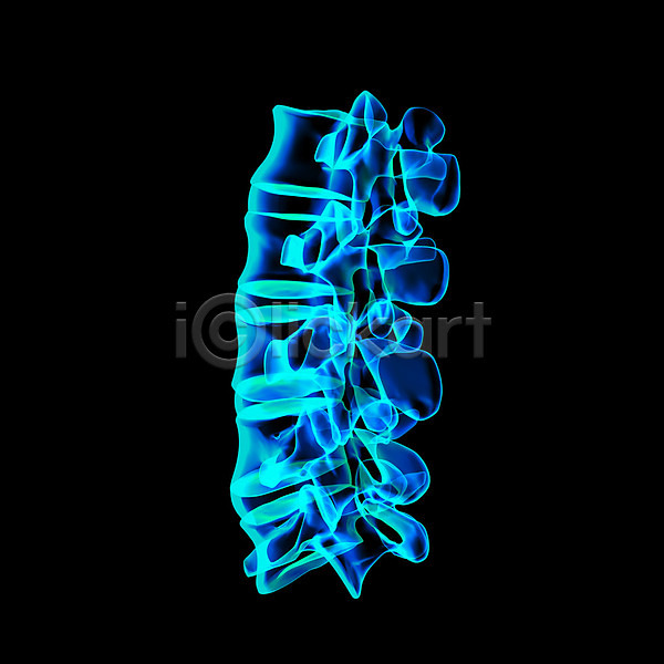 고통 사람없음 3D JPG 일러스트 포토 해외이미지 검은색 골격 관절염 몸통 백그라운드 뼈 신체 엑스레이 염증 요통 척추 투명 파란색 해외202004