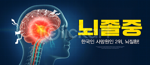 PSD 편집이미지 건강 경고 그래픽 뇌졸중 두뇌 신체 예방 응급 의학 이미지편집 정보 중요성 증상 질병 치료