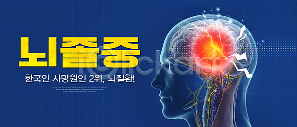 고통 PSD 편집이미지 건강 경고 뇌 뇌졸중 예방 이미지편집 증상 질병 치료 한국 혈관 혈압