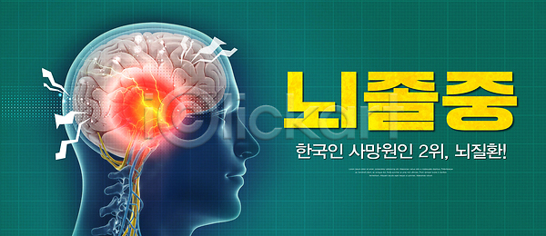 위험 PSD 편집이미지 건강 교육 뇌졸중 실험 예방 의식 이미지편집 정보 증상 치료 캠페인 한국