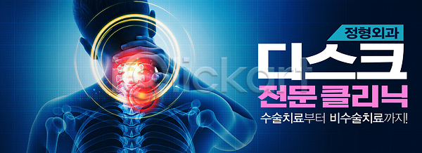 고통 PSD 배너템플릿 템플릿 건강 관리 목디스크 물리치료 상담 수술 의사 의학 전문 치료 클리닉 환자