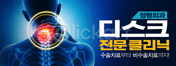 고통 PSD 배너템플릿 템플릿 검사(조사) 목디스크 방법 상담 수술 의사 전문 정형외과 척추 치료 클리닉 환자