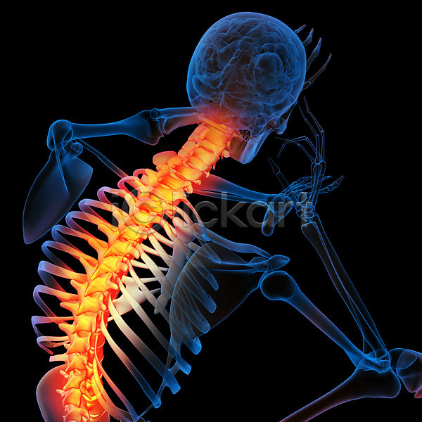 고통 사람없음 3D JPG 포토 해외이미지 건강 검은색 골격 관절염 몸통 방사선 뼈 신체 엑스레이 요통 질병 척추 해골모형 해외202004 환자