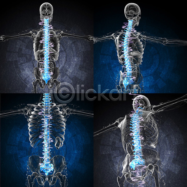 사람없음 3D JPG 포토 해외이미지 골격 몸통 방사선 뼈 요통 질병 척추 해외202004 환자