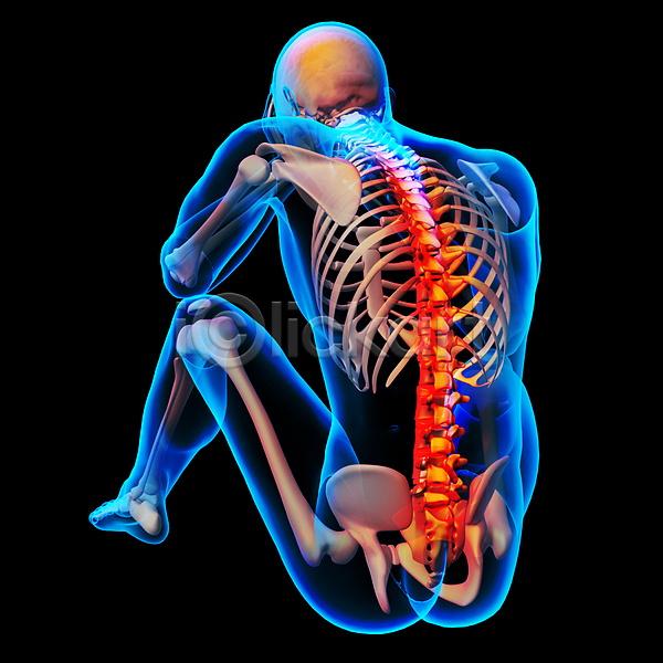 고통 사람없음 3D JPG 일러스트 포토 해외이미지 검은색 골격 관절염 몸통 백그라운드 뼈 신체 엑스레이 염증 요통 척추 투명 파란색 해외202004