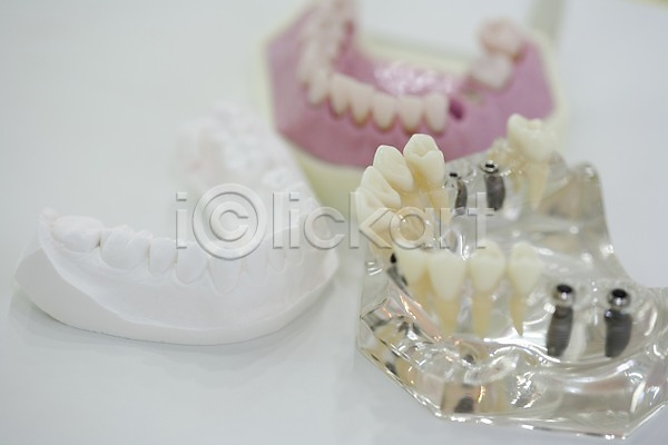 사람없음 JPG 아웃포커스 포토 모형 실내 의료용품 임플란트 치과 치과용품 치아 치아모형 티타늄