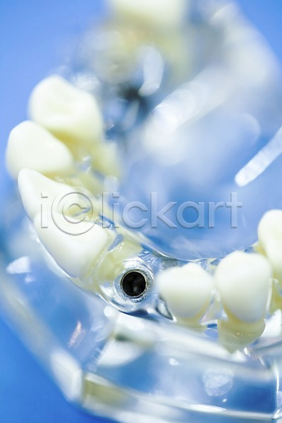 사람없음 JPG 근접촬영 아웃포커스 포토 하이앵글 구멍 모형 실내 의료용품 임플란트 치과 치과용품 치아 치아모형 티타늄