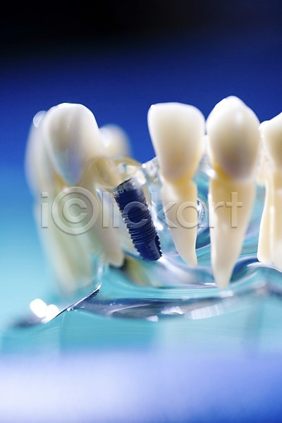 사람없음 JPG 근접촬영 아웃포커스 포토 모형 실내 의료용품 임플란트 치과 치과용품 치아 치아모형 티타늄