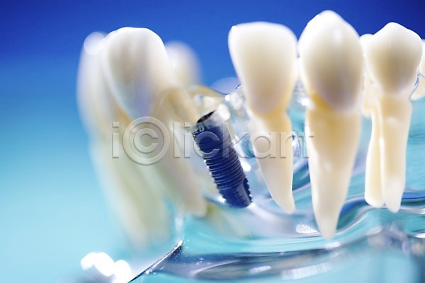 사람없음 JPG 근접촬영 아웃포커스 포토 모형 실내 의료용품 임플란트 치과 치과용품 치아 치아모형 티타늄