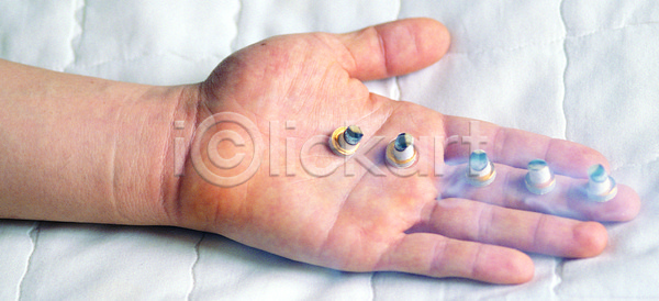 신체부위 한명 JPG 포토 하이앵글 국내포토 뜸 손 손바닥 신체 실내 연기 치료 한손 한의원 한의학