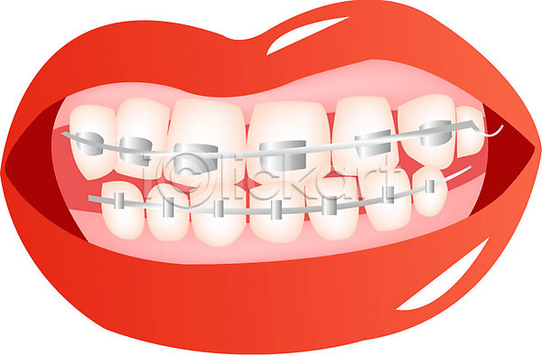 사람 신체부위 EPS 일러스트 교정 신체 입 입술 치과 치아 치아교정 클립아트