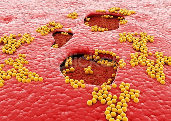 사람없음 3D PSD 입체 3D소스 그래픽 라이프 박테리아 백그라운드 빨간색 상처 생명 생명공학 세포 신체 의학 조직 치료 컬러 피부 현미경