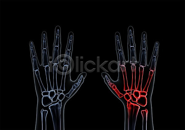 사람없음 신체부위 3D PSD 입체 3D소스 건강 골격 그래픽 병원 뼈 손 손가락 손가락뼈 손목 신체 엑스레이 의학 치료 투시 해부