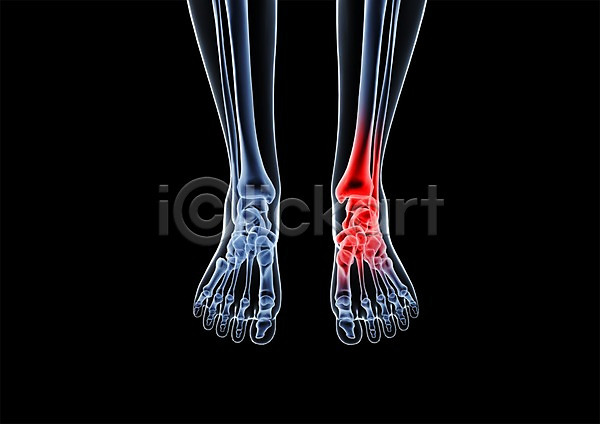 사람없음 신체부위 3D PSD 입체 3D소스 건강 골격 그래픽 다리(신체부위) 다리뼈 발 발가락 발가락뼈 발목 발뼈 병원 뼈 신체 엑스레이 의학 치료 투시 해부