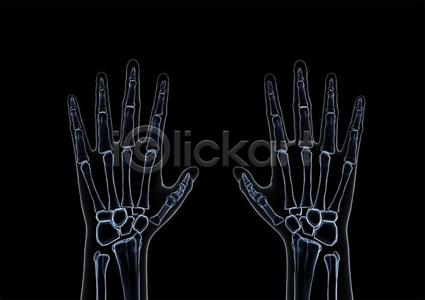 사람없음 신체부위 3D PSD 입체 3D소스 건강 골격 그래픽 병원 뼈 손 손가락 손가락뼈 신체 엑스레이 의학 치료 투시 해부