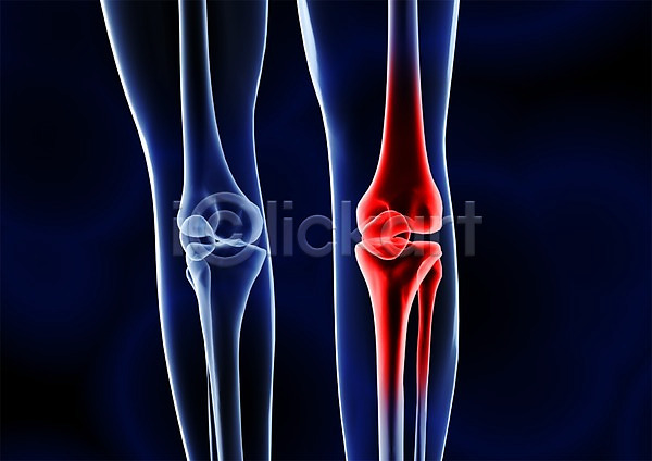 사람없음 신체부위 3D PSD 입체 3D소스 건강 골격 관절 관절염 그래픽 다리(신체부위) 다리뼈 무릎 병원 뼈 신체 엑스레이 의학 치료 투시 해부