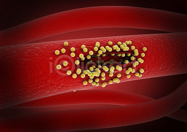 사람없음 3D PSD 입체 3D소스 그래픽 라이프 박테리아 백그라운드 빨간색 생명 생명공학 세포 신체 의학 조직 치료 컬러 피 현미경 혈관 혈소판 혈액