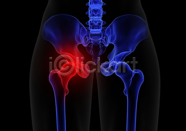 사람없음 신체부위 3D PSD 입체 3D소스 건강 고관절 골격 골반뼈 관절 그래픽 병원 뼈 신체 엉덩이 엉덩이뼈 엑스레이 의학 장기(의학) 치료 투시 해부 허리
