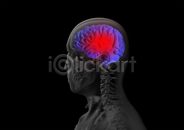 사람없음 신체부위 3D PSD 입체 3D소스 건강 그래픽 뇌 두뇌 머리 병원 신체 엑스레이 의학 장기(의학) 치료 투시 해부