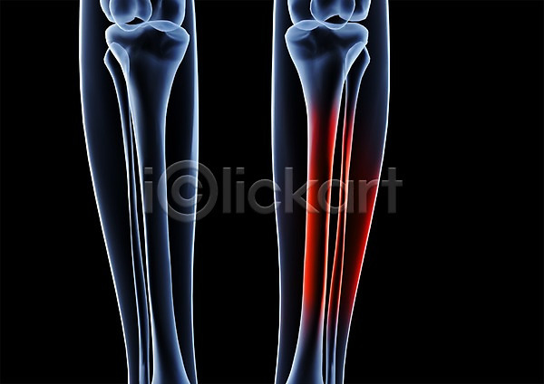 사람없음 신체부위 3D PSD 입체 3D소스 건강 골격 그래픽 다리(신체부위) 다리뼈 병원 뼈 신체 엑스레이 의학 종아리 치료 투시 해부
