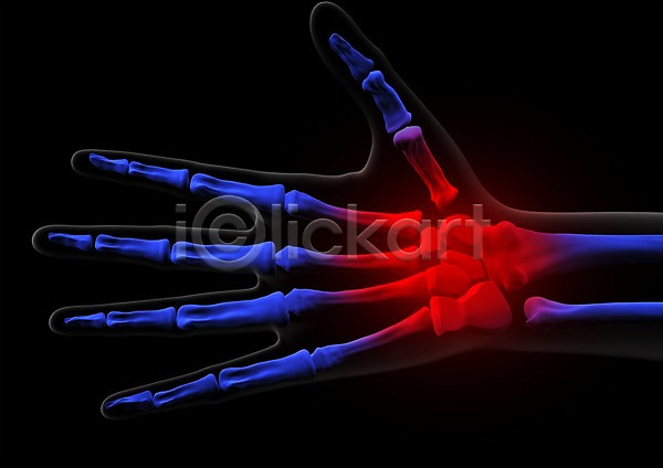 사람없음 신체부위 3D PSD 입체 3D소스 건강 골격 관절 그래픽 병원 뼈 손 손가락 손가락뼈 신체 엑스레이 의학 치료 투시 해부