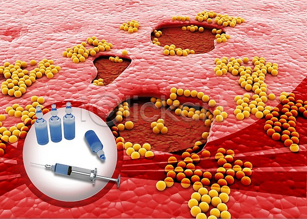 사람없음 3D PSD 입체 편집이미지 건강 그래픽 라이프 바늘(도구) 박테리아 백그라운드 빨간색 상처 생명 생명공학 세포 수술도구 신체 약 의료기기 의료용품 의학 조직 주사기 주사약 치료 컬러 편집 피부 현미경