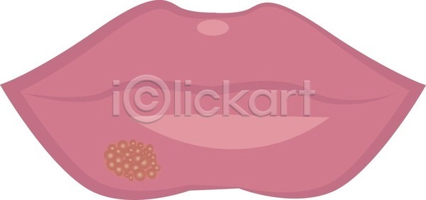 고통 추위 사람 여자 EPS 일러스트 해외이미지 감염 건강 고립 구내염 돌봄 문제 바이러스 백그라운드 알레르기 약 얼굴 열 염증 입 입술 전염 조직 증상 질병 치료 해외202004 해외일러스트 흰색