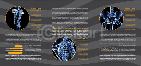 사람없음 AI(파일형식) 템플릿 3단접지 골반 그래프 내지 디스크(질병) 리플렛 백그라운드 북디자인 북커버 뼈 신체 엑스레이 의학 정형외과 척추 출판디자인 치료 팜플렛 편집 표지디자인