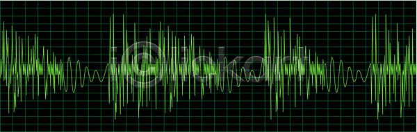 계획 EPS 일러스트 해외이미지 건강 검은색 그림 네온 디자인 리듬 맥박 백그라운드 빛 샐러드 선 약 장식 지그재그 초록색 파도 패턴 하트 해외202004 해외일러스트