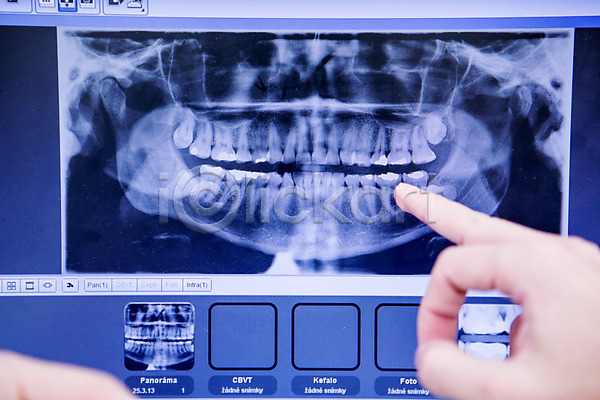 20대 남자 백인 성인 신체부위 한명 JPG 포토 CT촬영 가리킴 관찰 노트북 손 치과 치과의사 한손