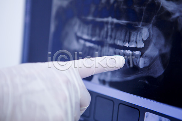 20대 남자 백인 성인 신체부위 한명 JPG 포토 CT촬영 가리킴 관찰 노트북 손 치과 치과의사 한손